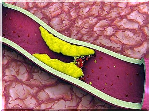 Cholesterol