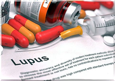 Everything you should know about lupus