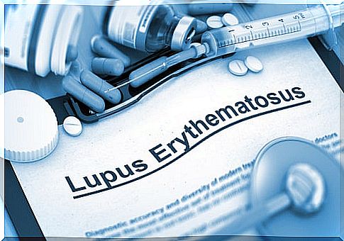 Types of lupus