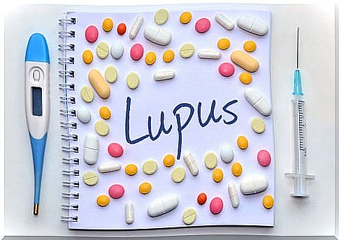 It is possible to recognize lupus