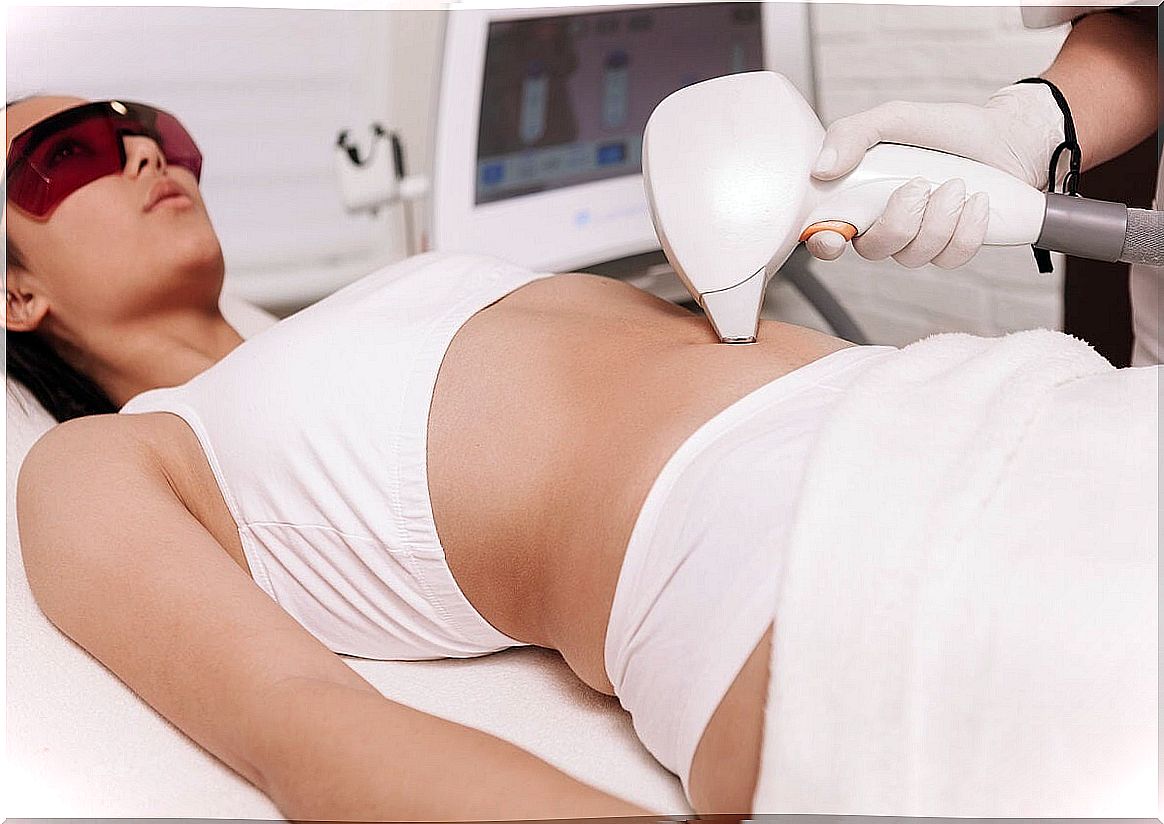 How does laser hair removal work?