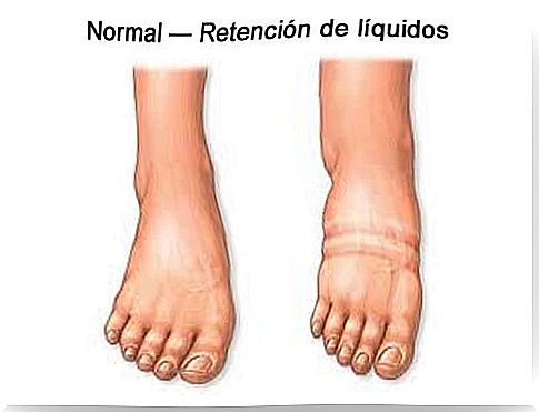 How to act when we have fluid retention?