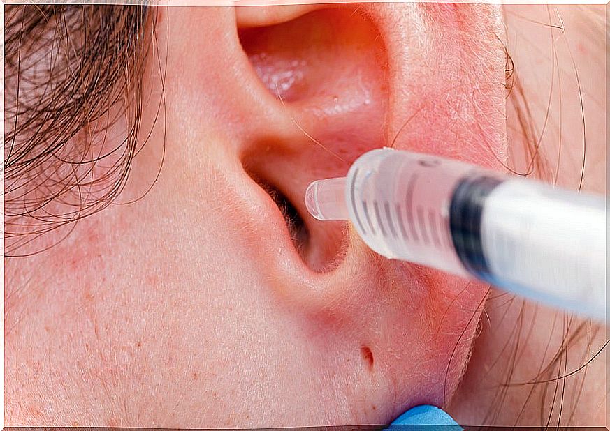 How To Remove Excess Ear Wax Naturally