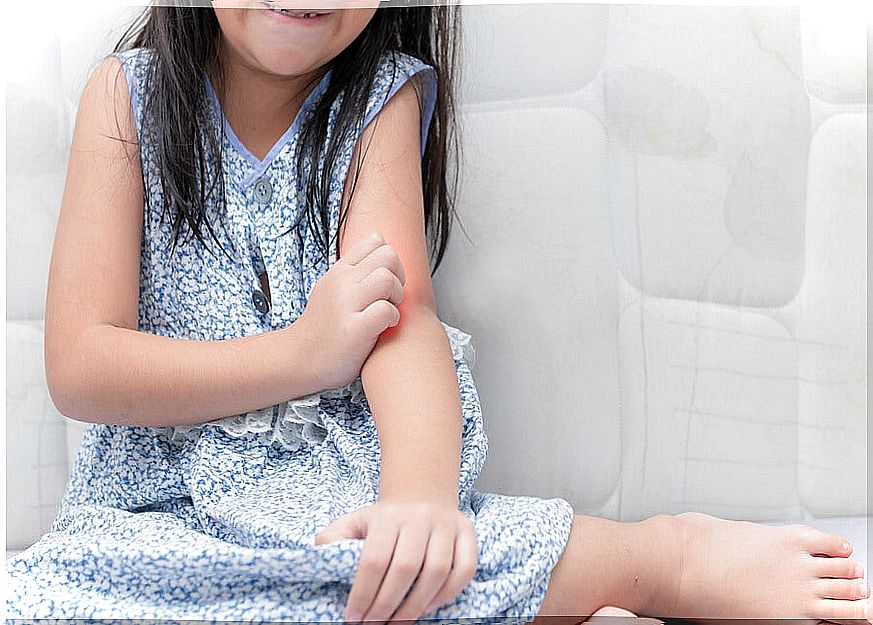 Psoriasis in children: how to deal with it?