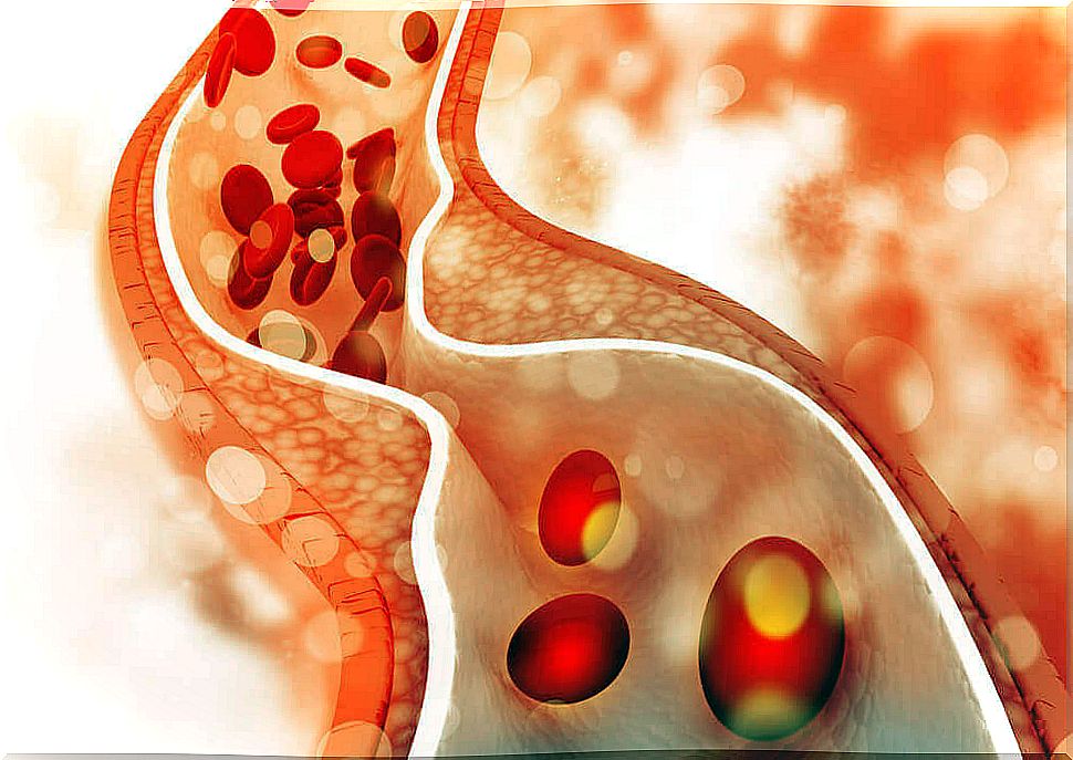 Cholesterol.