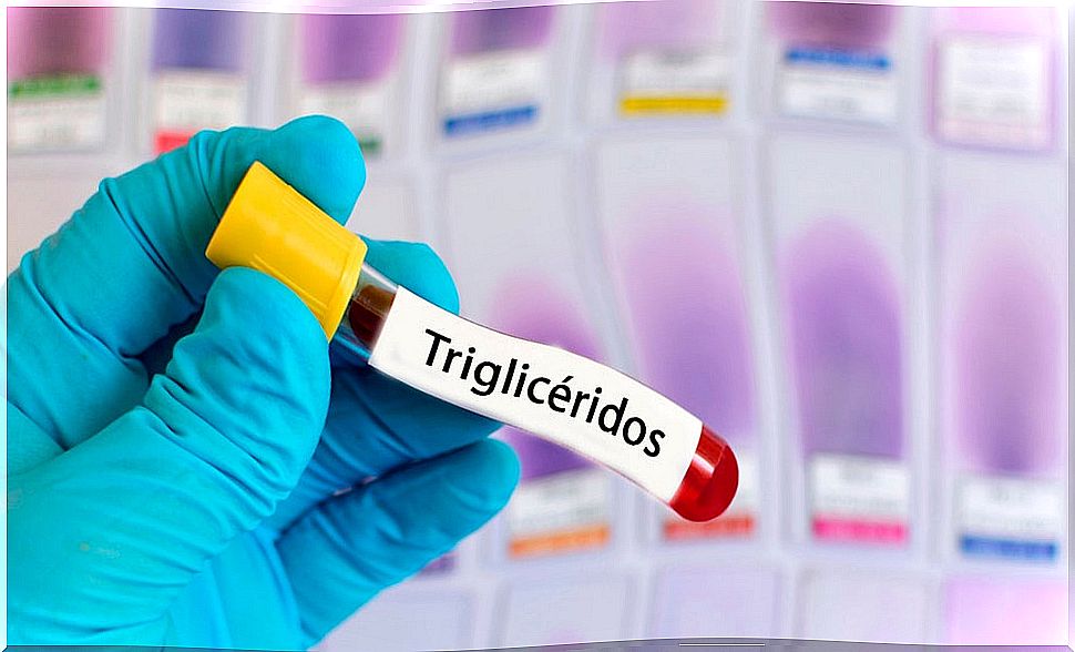 To-reduce-triglycerides-drugs-such as-fibrates-or-nicotinic-acid-are-used.