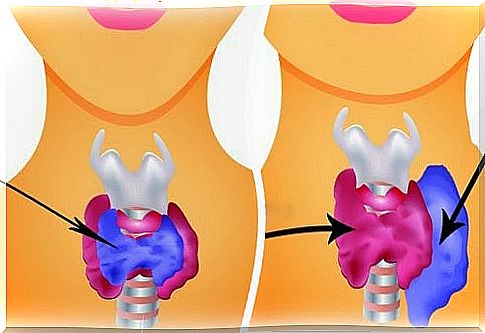 Hypothyroidism and hyperthyroidism