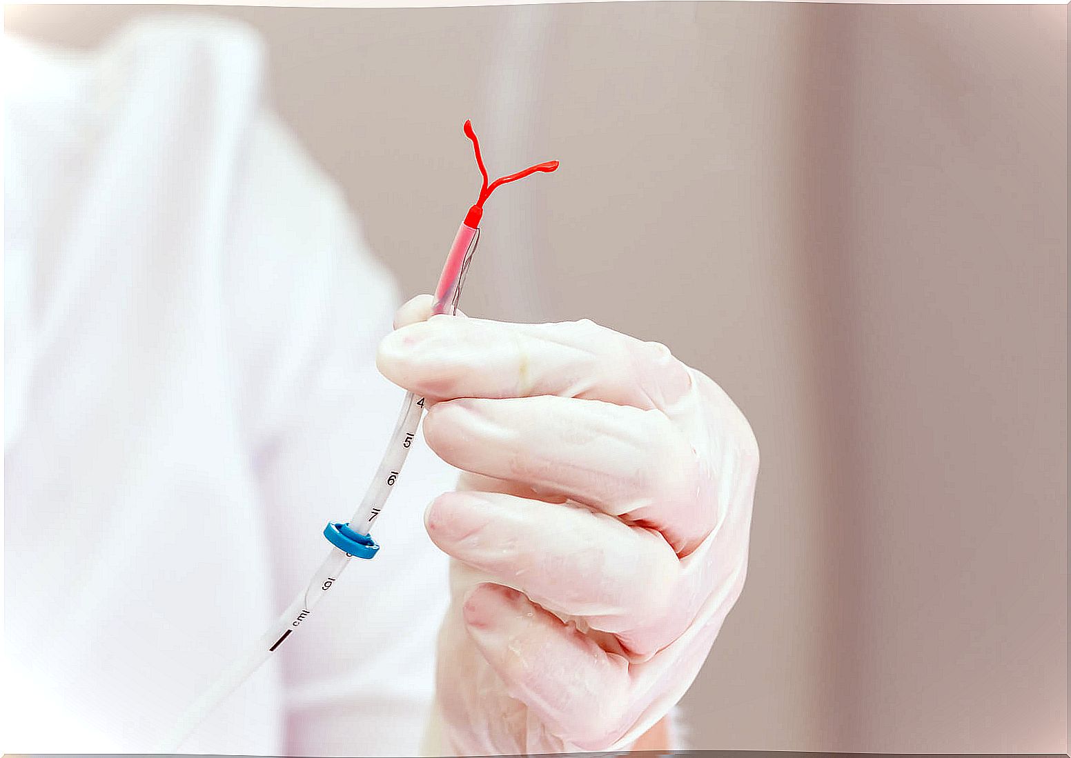 Gynecologist holding an IUD.