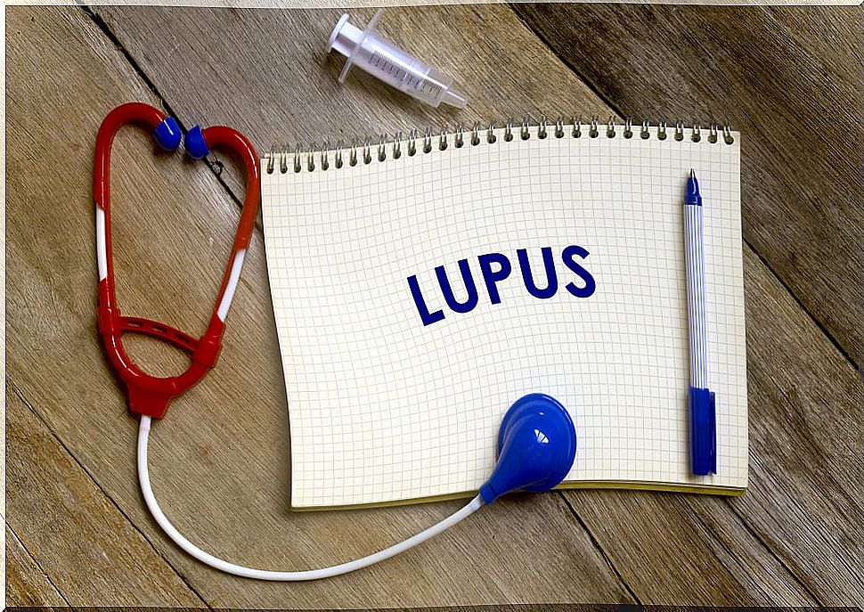 What are the risk factors for lupus?