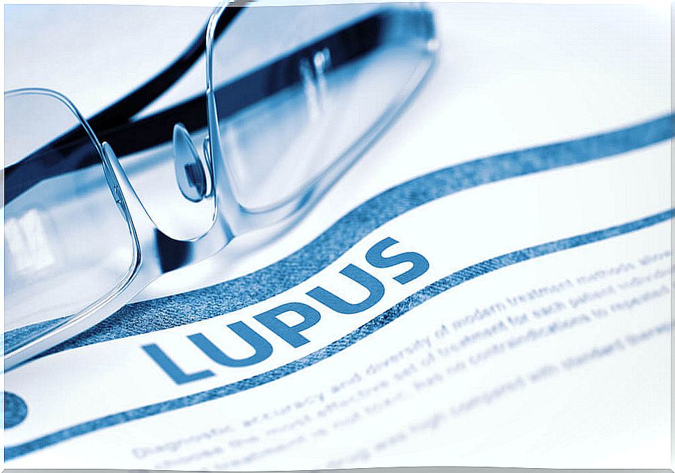 Lupus