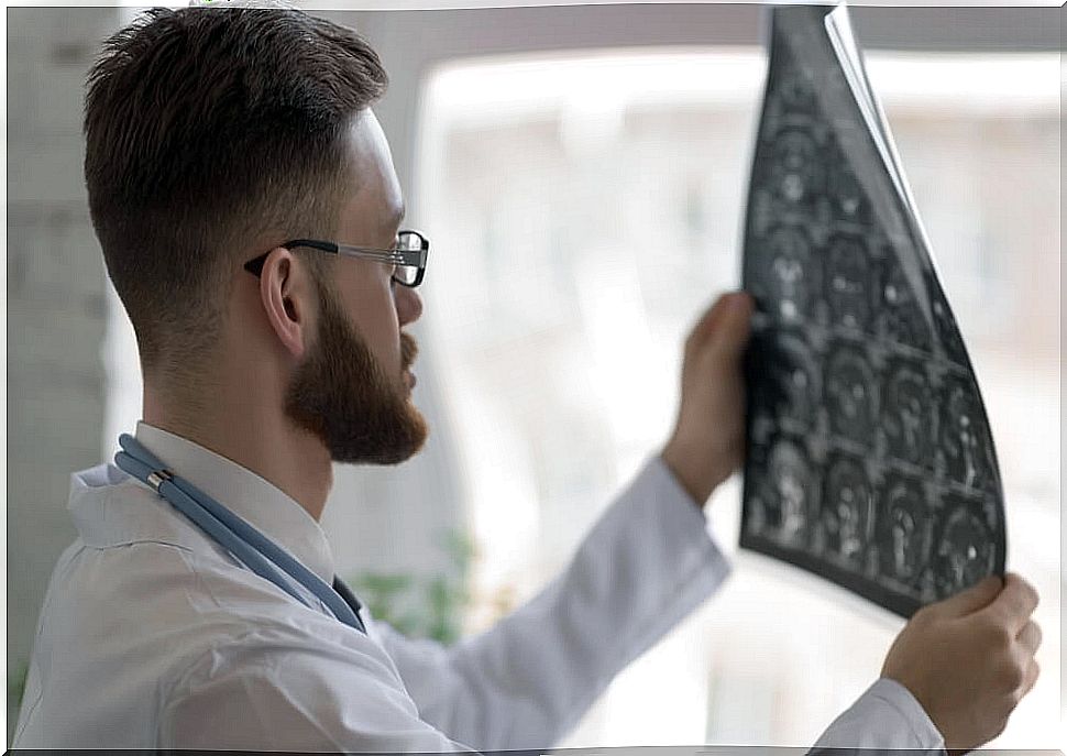 Etiology of acute cerebellar ataxia